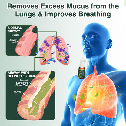 ✅UK Official Store:CareBreeze® Botanical Mullein Leaf Extract Lung Cleanse Spray（👨‍⚕️Directly acts on COPD, asthma, chronic bronchitis (CB), respiratory infections, lung cancer, sinusitis, and other conditions）